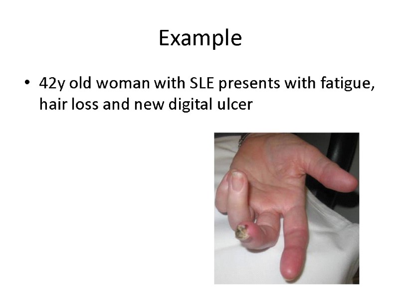 Example 42y old woman with SLE presents with fatigue, hair loss and new digital